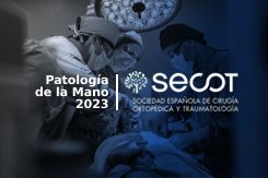 Patología de la Mano (3ª Ed.) Fracturas y lesiones articulares de la mano y muñeca
